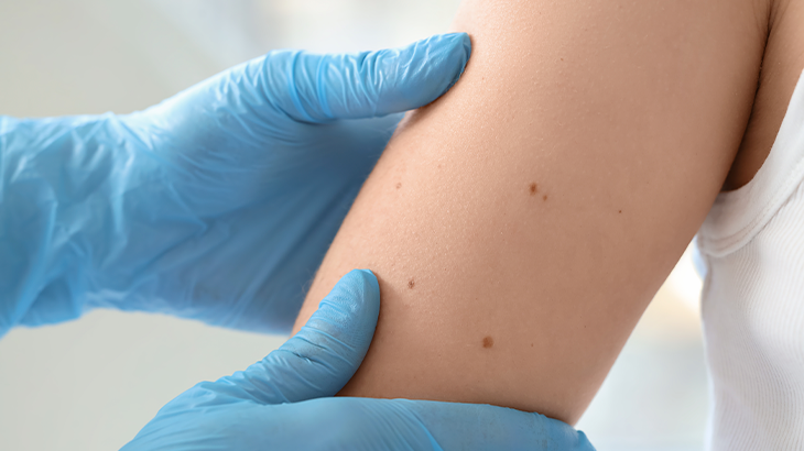 Dermatologista avaliando o braço do paciente